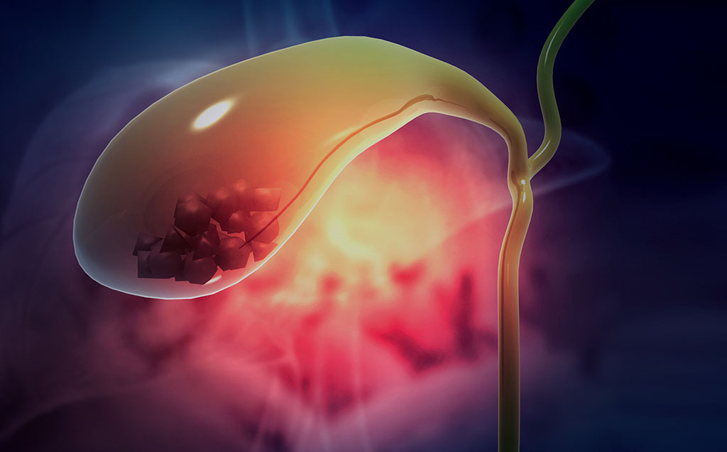 Specialise Services - Gallbladder