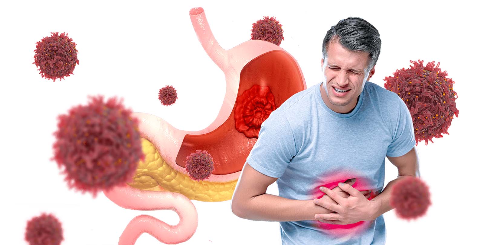 Gallbladder Surgery - Biliary Colic